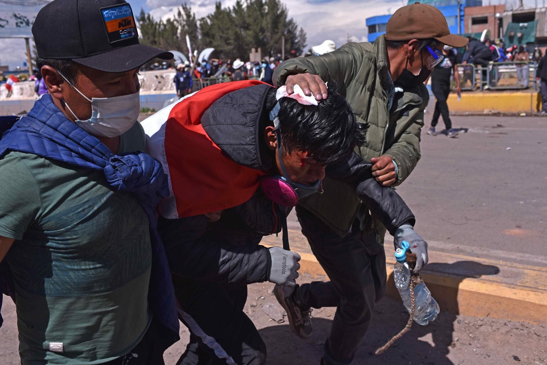 Un manifestante herido durante la jornada de protestas en Juliaca, Perú, este lunes. EFE