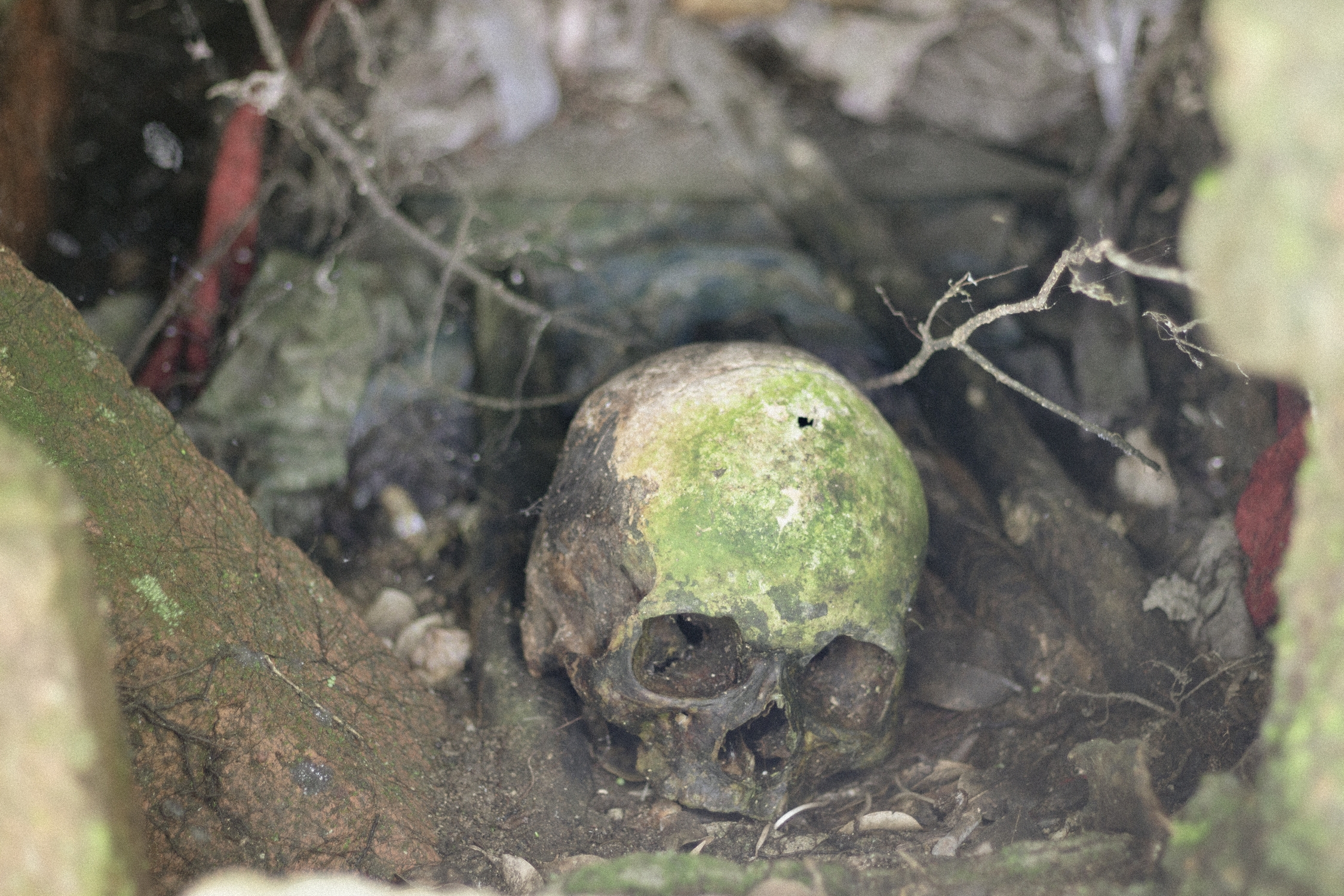 Cráneo sin identificar en una tumba exhumada en el cementerio de Vistahermosa, Meta. MTQ Cráneo sin identificar en una tumba exhumada en el cementerio de Vistahermosa, Meta. MTQ