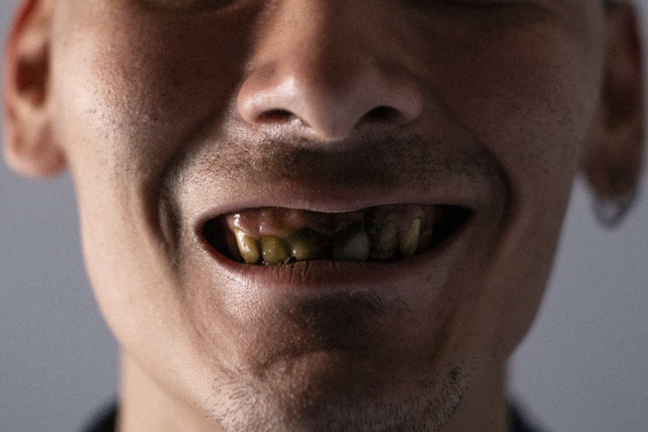 Dientes manchados por el mambe, preparación ancestral de pueblos amazónicos como símbolo de reflexión y diálogo. MTQ Dientes manchados por el mambe, preparación ancestral de pueblos amazónicos como símbolo de reflexión y diálogo. MTQ